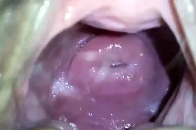 my japanese girlfend's cute cervix in huge hole